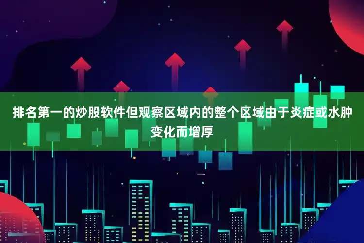 排名第一的炒股软件但观察区域内的整个区域由于炎症或水肿变化而增厚